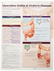 Image for Ulcerative Colitis &amp; Crohn&#39;s Disease Anatomical Chart Laminated