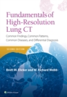 Image for Fundamentals of High-Resolution Lung CT : Common Findings, Common Patterns, Common Diseases and Differential Diagnosis