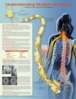 Image for Understanding Multiple Sclerosis Anatomical Chart