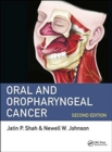 Image for Oral and Oropharyngeal Cancer