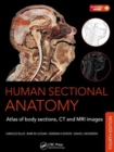Image for Human sectional anatomy  : atlas of body sections, CT and MRI images