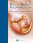 Image for Partial breast reconstruction  : techniques in oncoplastic surgery