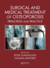 Image for Surgical and Medical Treatment of Osteoporosis