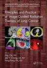 Image for Principles and Practice of Image-Guided Radiation Therapy of Lung Cancer
