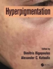Image for Hyperpigmentation