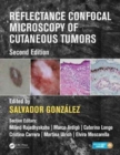 Image for Reflectance Confocal Microscopy of Cutaneous Tumors