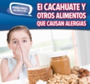 Image for El cacahuate y otros alimentos que causan alergias (Peanut and Other Food Allergies)