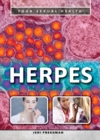 Image for Herpes