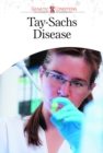 Image for Tay-Sachs Disease