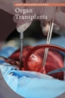 Image for Organ transplants