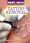 Image for Tattoo Removal