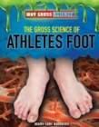 Image for Gross Science of Athlete&#39;s Foot