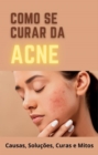Image for Como se curar da Acne 