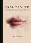 Image for Oral Cancer