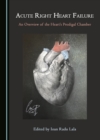 Image for Acute Right Heart Failure: An Overview of the Heart&#39;s Prodigal Chamber