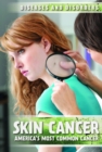 Image for Skin cancer: America&#39;s most common cancer