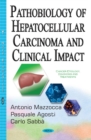 Image for Pathobiology of Hepatocellular Carcinoma &amp; Clinical Impact