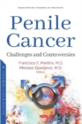Image for Penile Cancer