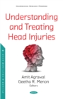 Image for Understanding and Treating Head Injuries