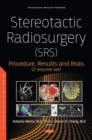 Image for Stereotactic radiosurgery (SRS)  : procedure, results and risks