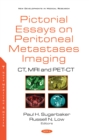 Image for Pictorial Essays on Peritoneal Metastases Imaging: CT, MRI and PET-CT