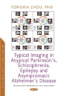 Image for Typical imaging in atypical Parkinson&#39;s, schizophrenia, epilepsy and asymptomatic alzheimer&#39;s disease