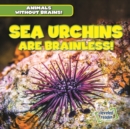 Image for Sea Urchins Are Brainless!