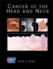 Image for Cancer of the Head and Neck