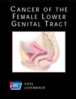 Image for CANCER OF FEMALE LOWER GENITAL TRACT