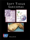 Image for SOFT TISSUE SARCOMAS (AMERICAN CANCER SOCIETY ATLAS OF CLINICAL ONCOLOGY)