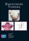 Image for Endocrine Tumors