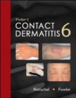 Image for Fisher&#39;s contact dermatitis