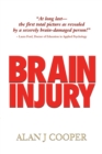 Image for Brain injury