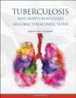 Image for Tuberculosis and Nontuberculous Mycobacterial Infections