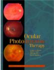 Image for Ocular Photodynamic Therapy