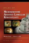 Image for Atlas of Microkeratome Assisted Lamellar Keratoplasty