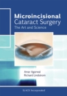 Image for Microincisional Cataract Surgery : The Art and Science