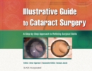 Image for Illustrative Guide to Cataract Surgery