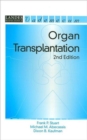 Image for Organ Transplantation