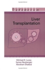 Image for Liver Transplantation