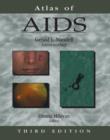 Image for Atlas of AIDS