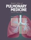 Image for Bone&#39;s Atlas of Pulmonary Medicine