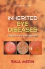 Image for Inherited eye diseases