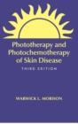Image for Phototherapy and Photochemotherapy for Skin Disease