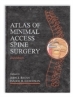 Image for Atlas of Minimal Access Spine Surgery