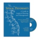 Image for Spinal Deformity : A Guide to Surgical Planning and Management