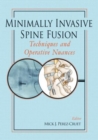 Image for Minimally Invasive Spine Fusion : Techniques and Operative Nuances