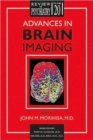 Image for Advances in Brain Imaging