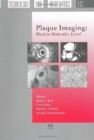 Image for Plaque Imaging