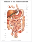 Image for Diseases of the Digestive System Anatomical Chart